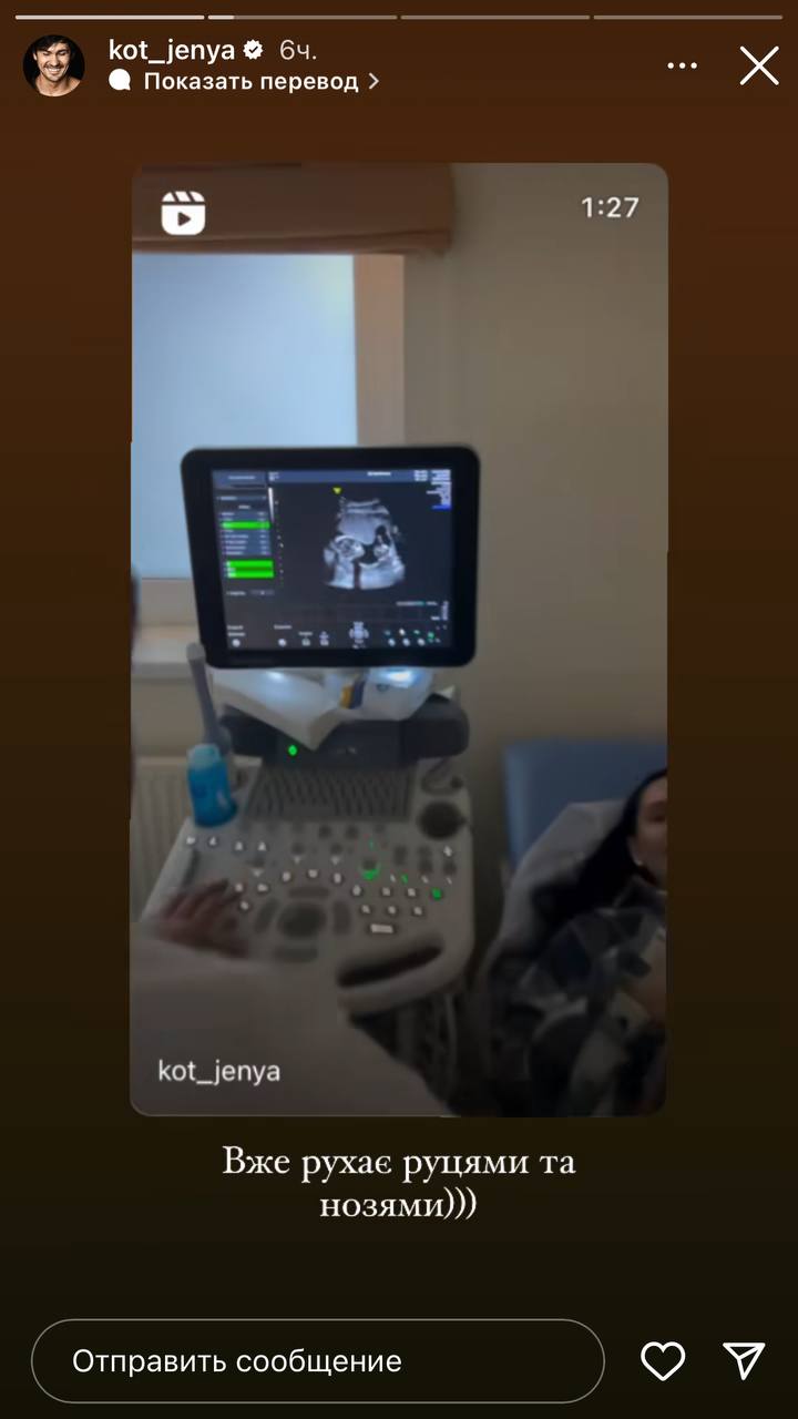 "Уже двигает нозями и ручками": Евгений Кот показал первые кадры малыша на УЗИ (видео)